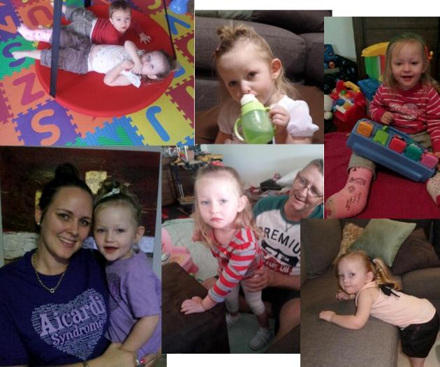 aicardi syndrome australia